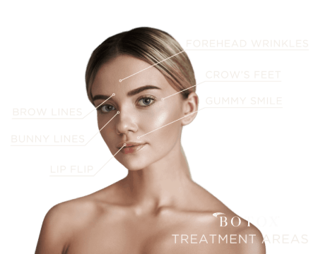 Botox treatment areas