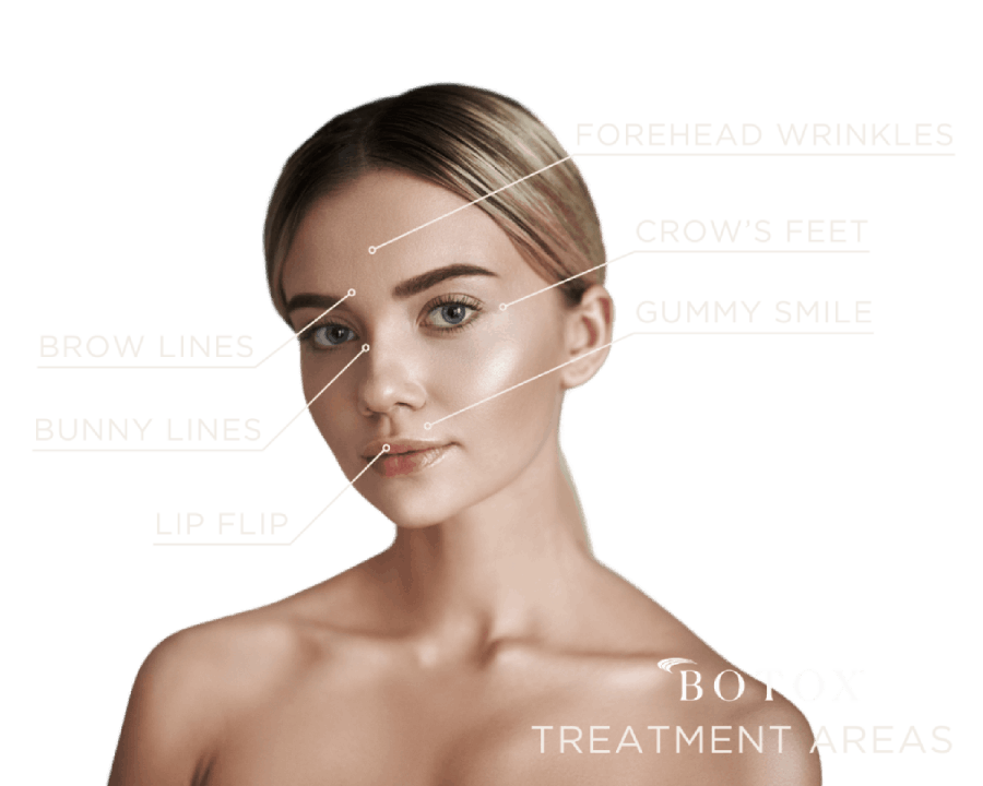 Botox treatment areas